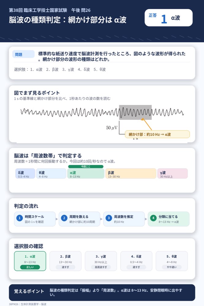 38PM26の解説画像