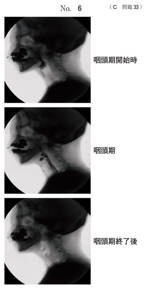 118C033の問題画像
