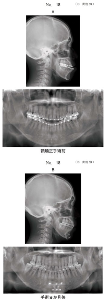 118B059の問題画像