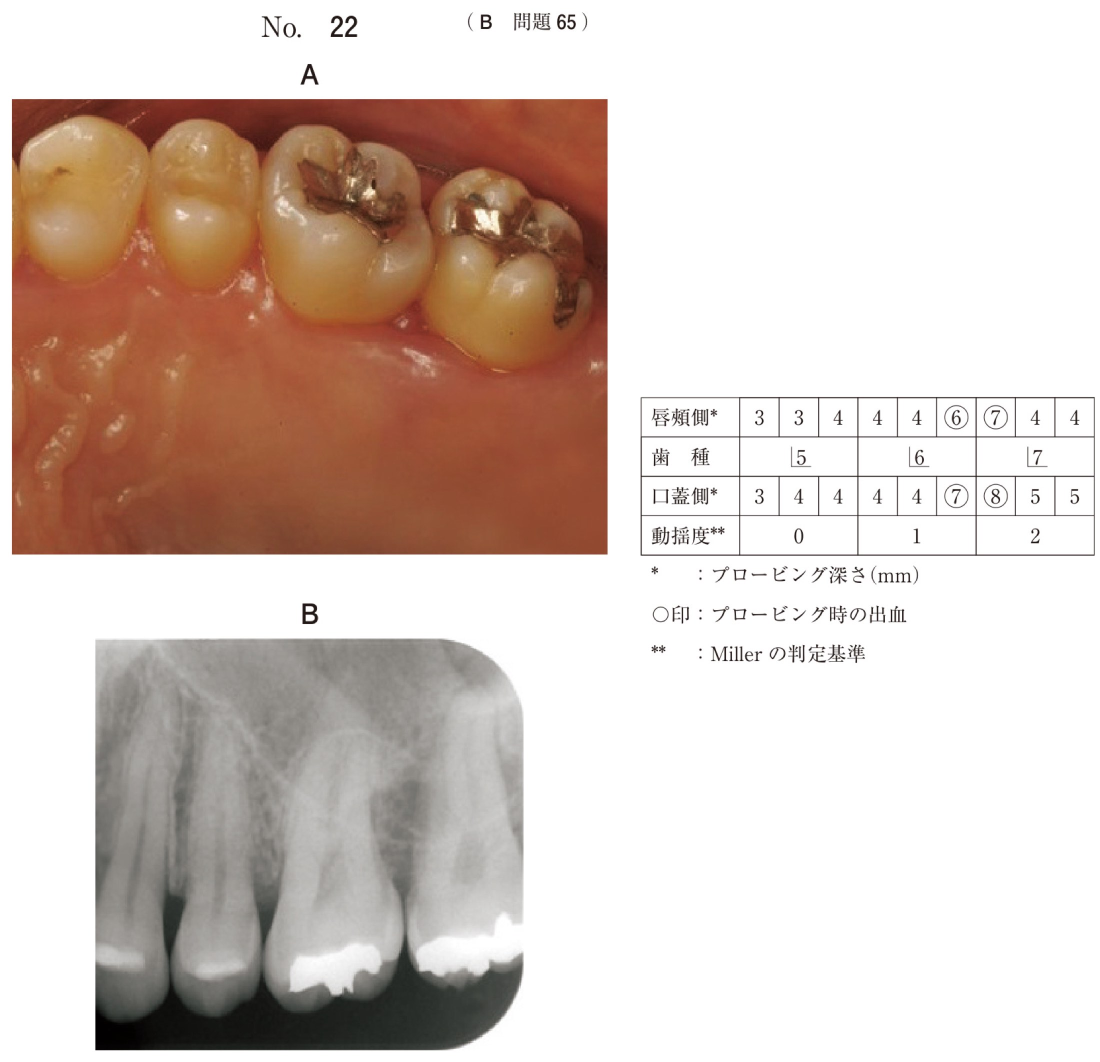 114B065の問題画像