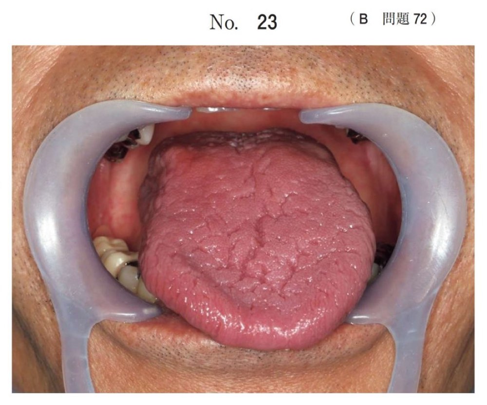 118B072の問題画像