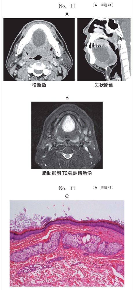 115A041の問題画像