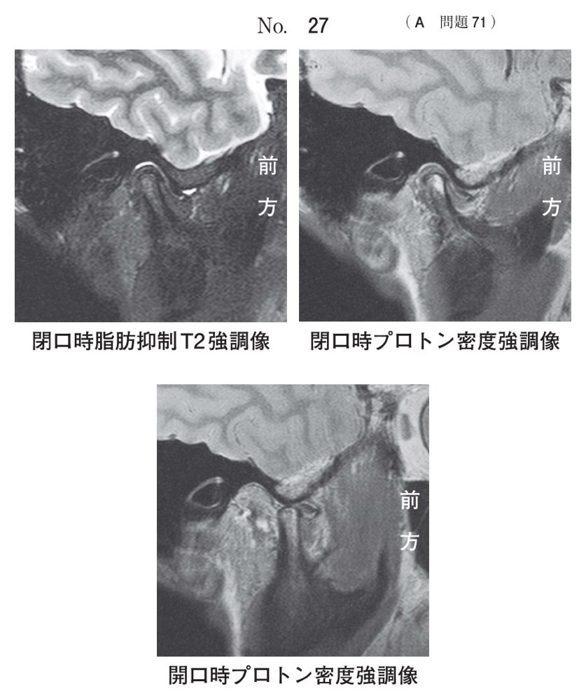 115A071の問題画像