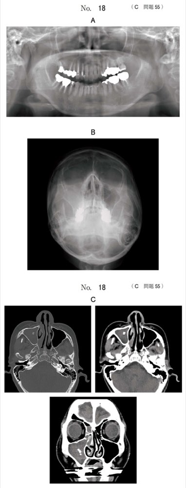 118C055の問題画像