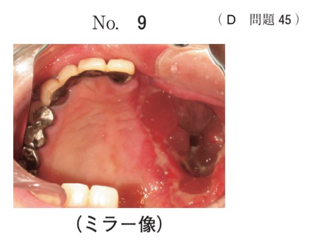 119D045の問題画像