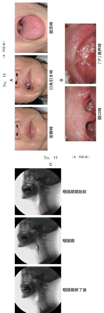 118A045の問題画像