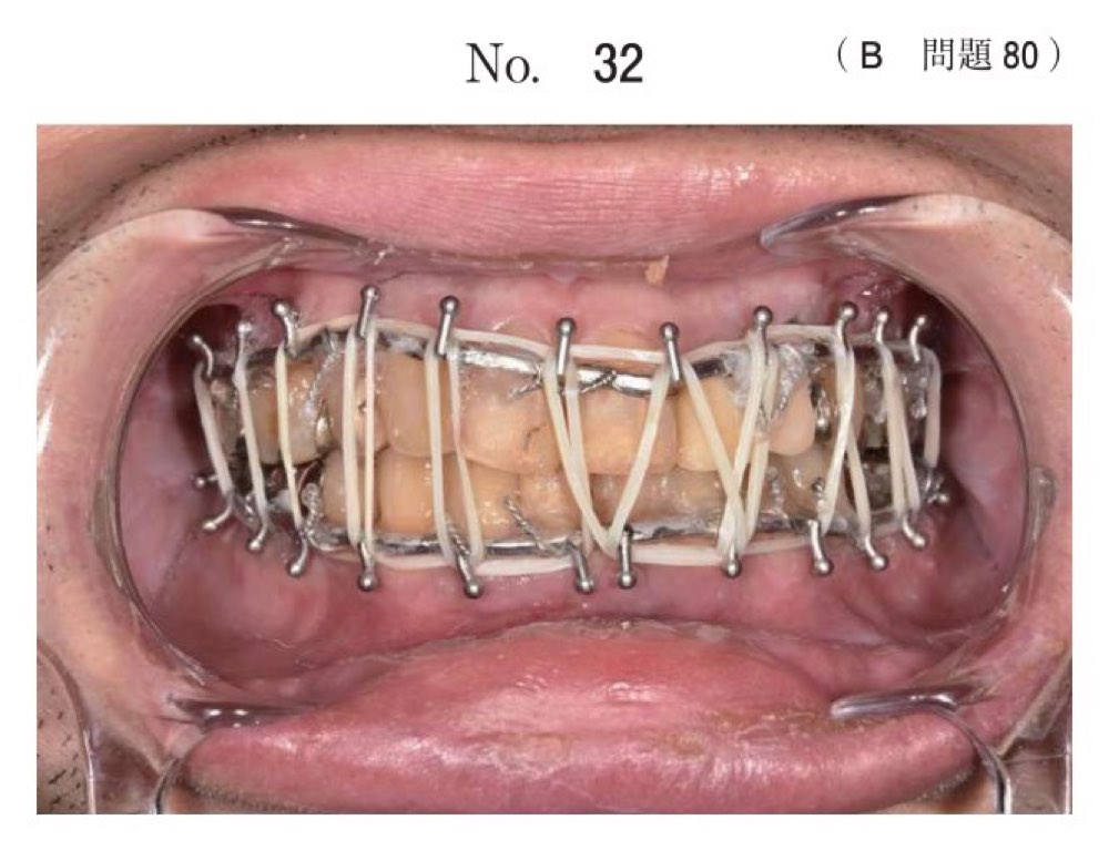 116B080の問題画像