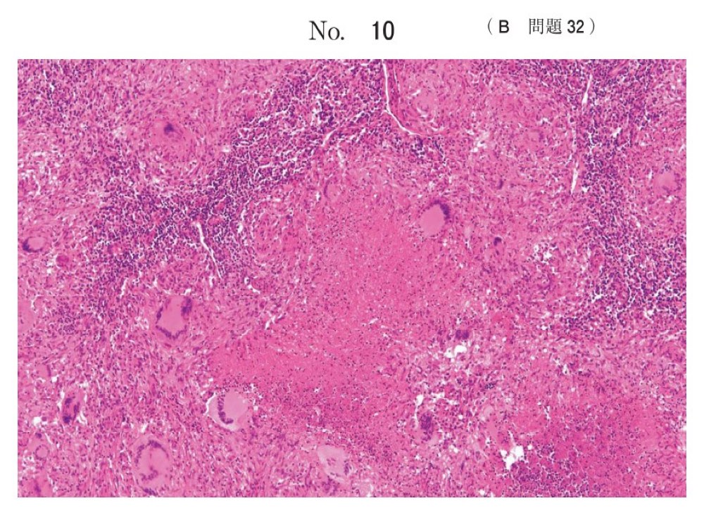117B032の問題画像