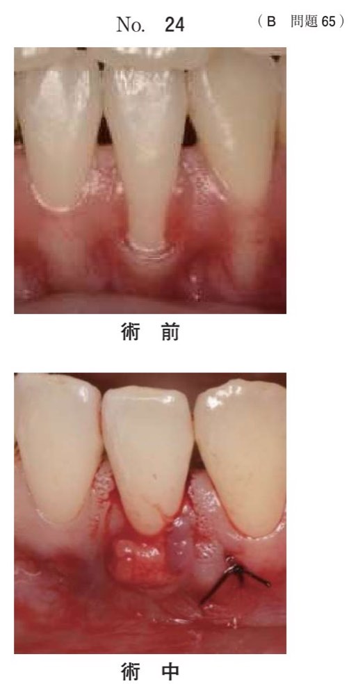 116B065の問題画像