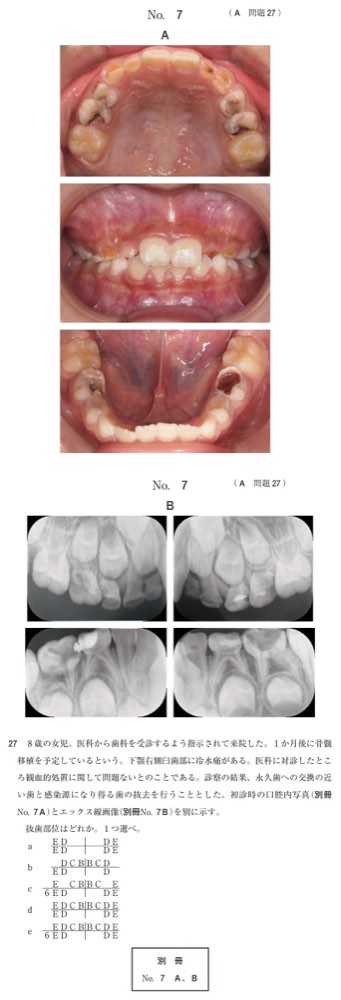 117A027の問題画像