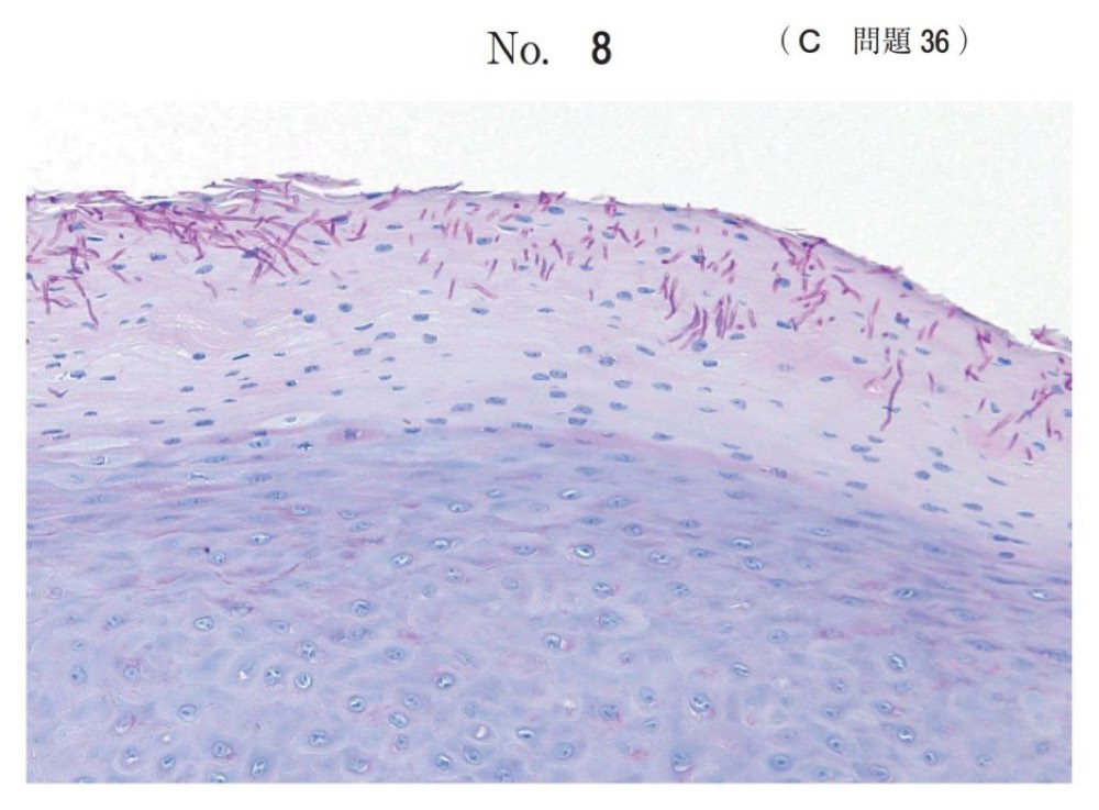 118C036の問題画像
