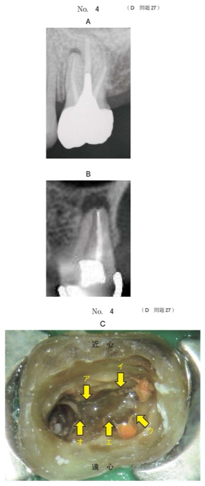 115D027の問題画像