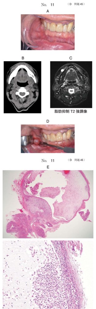 115D045の問題画像