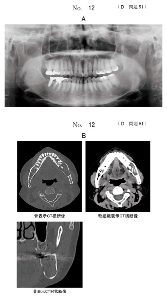 119D051の問題画像
