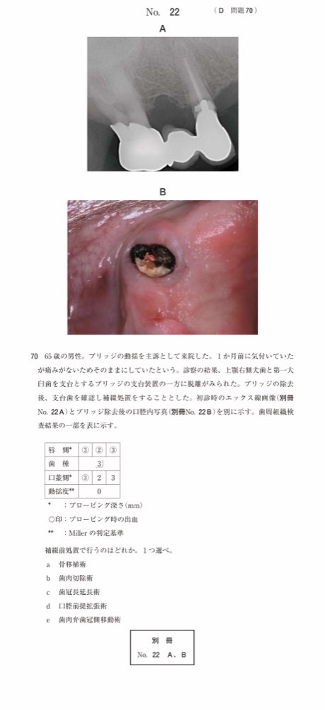 117D070の問題画像