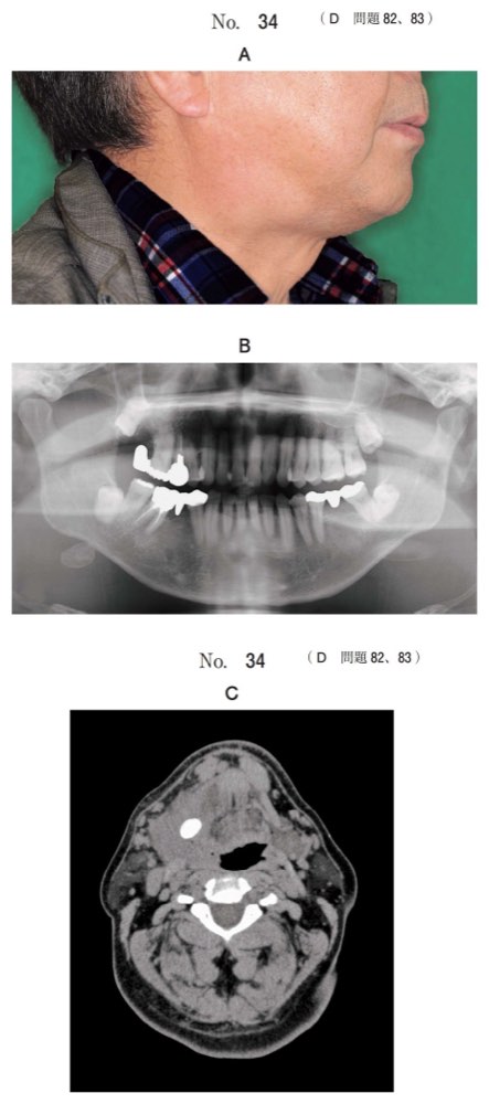 118D082の問題画像