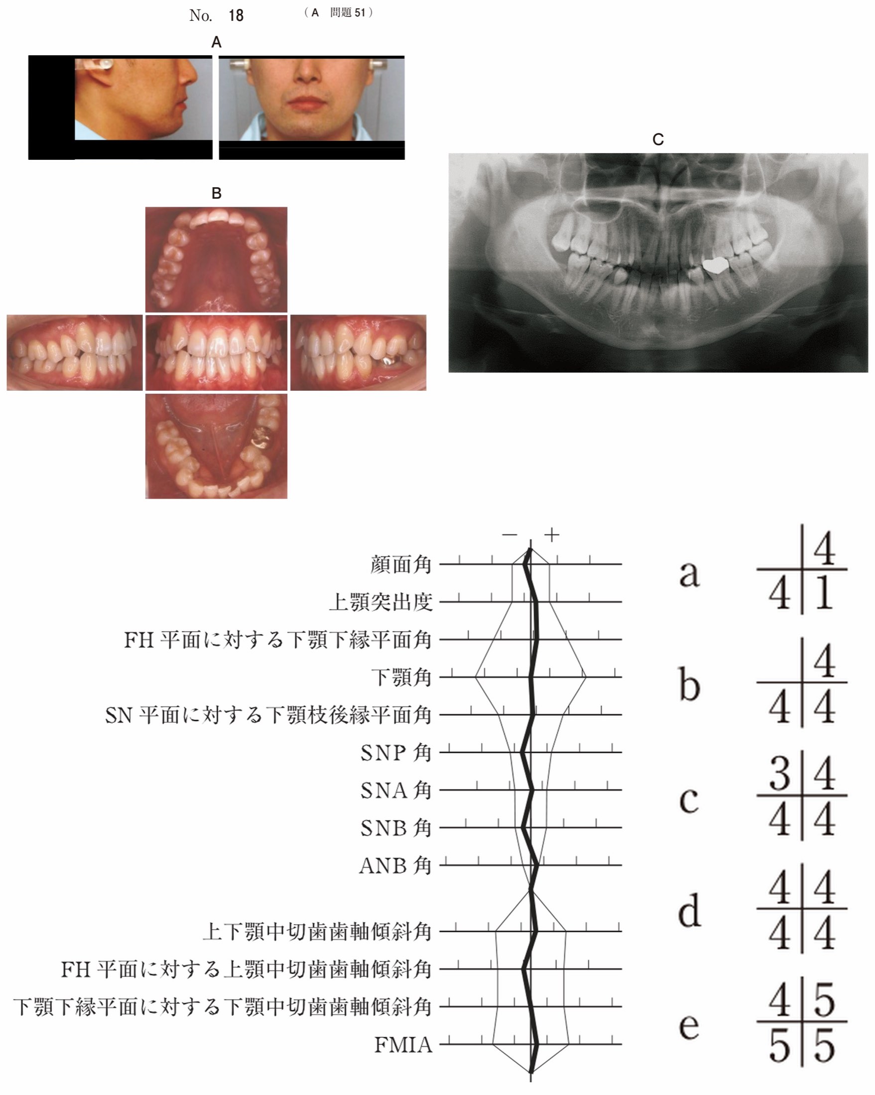 114A051の問題画像