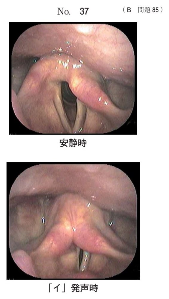116B085の問題画像