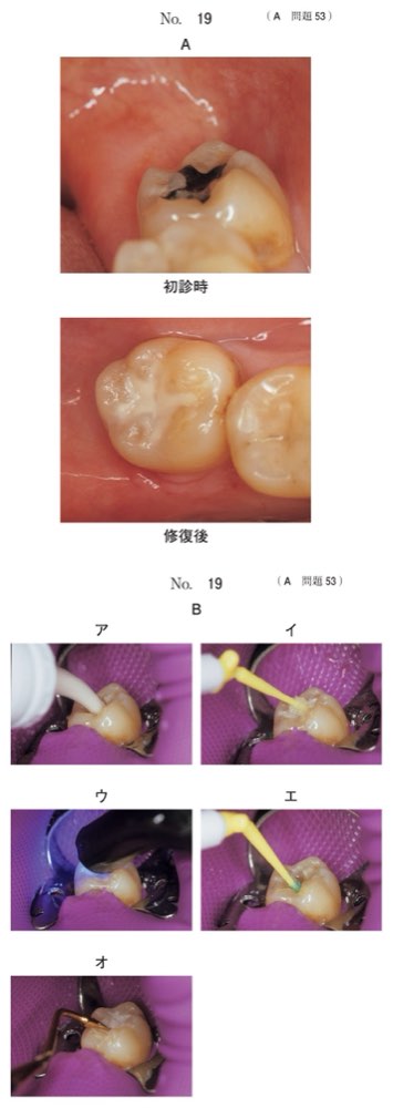 117A053の問題画像