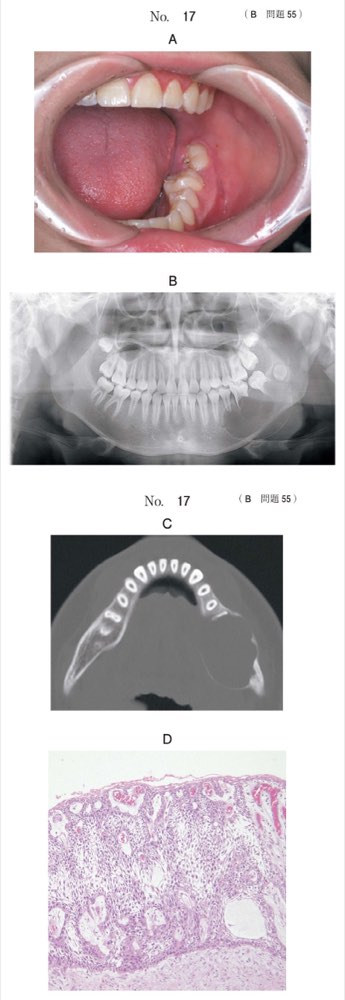 117B055の問題画像