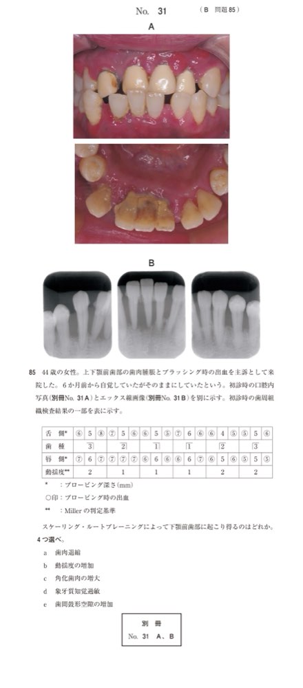 117B085の問題画像