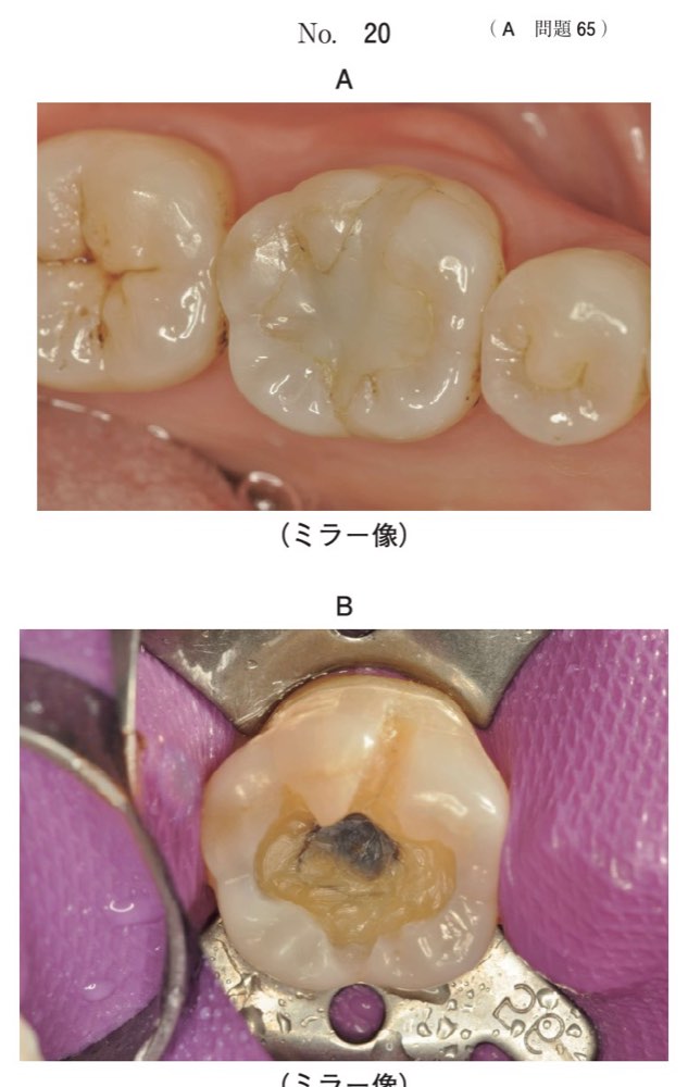 119A065の問題画像
