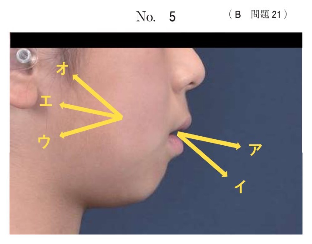 116B021の問題画像