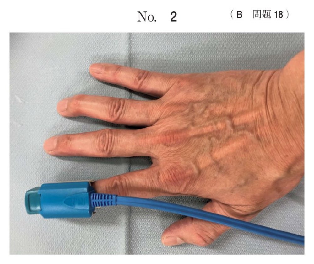 117B018の問題画像