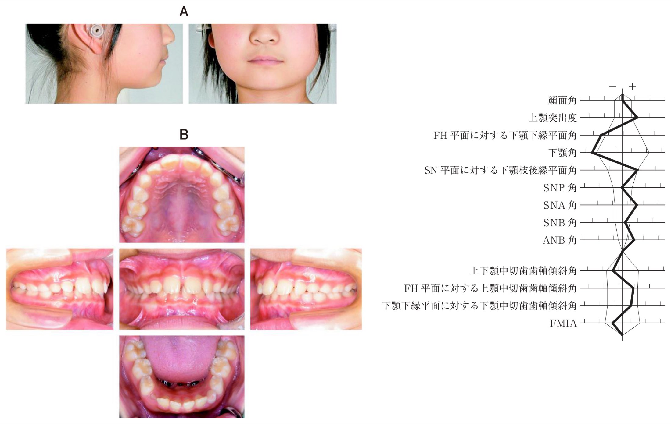 113B067の問題画像