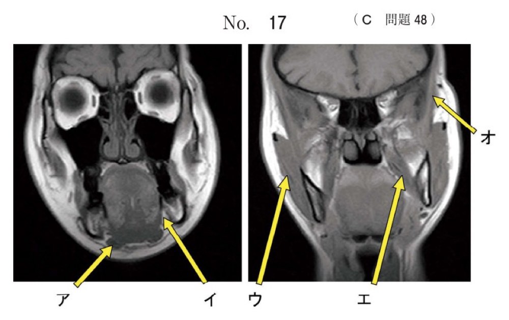 119C048の問題画像