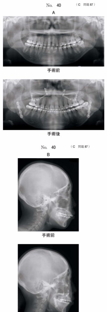 117C087の問題画像