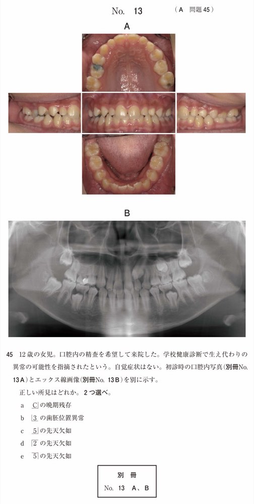 115A045の問題画像
