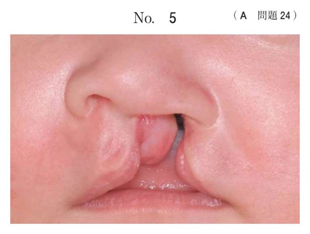 117A024の問題画像