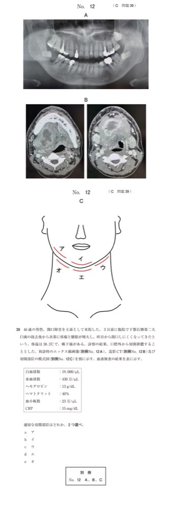 116C039の問題画像