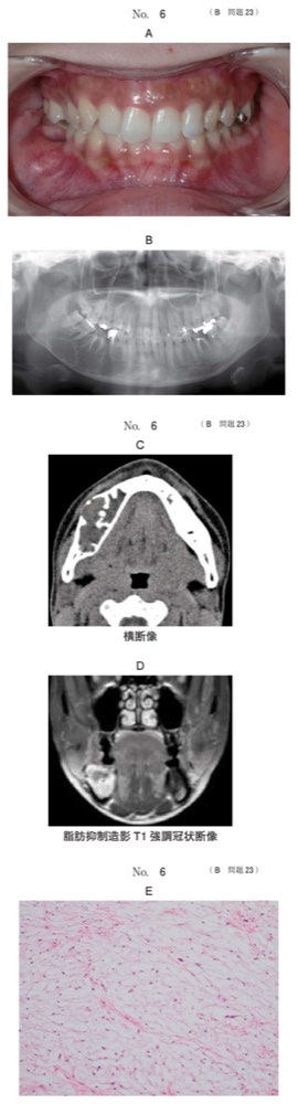 116B023の問題画像