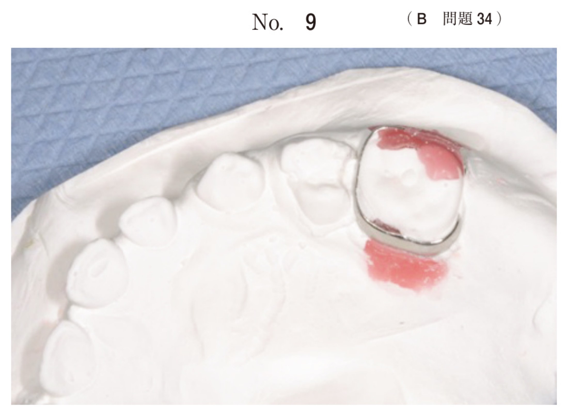114B034の問題画像