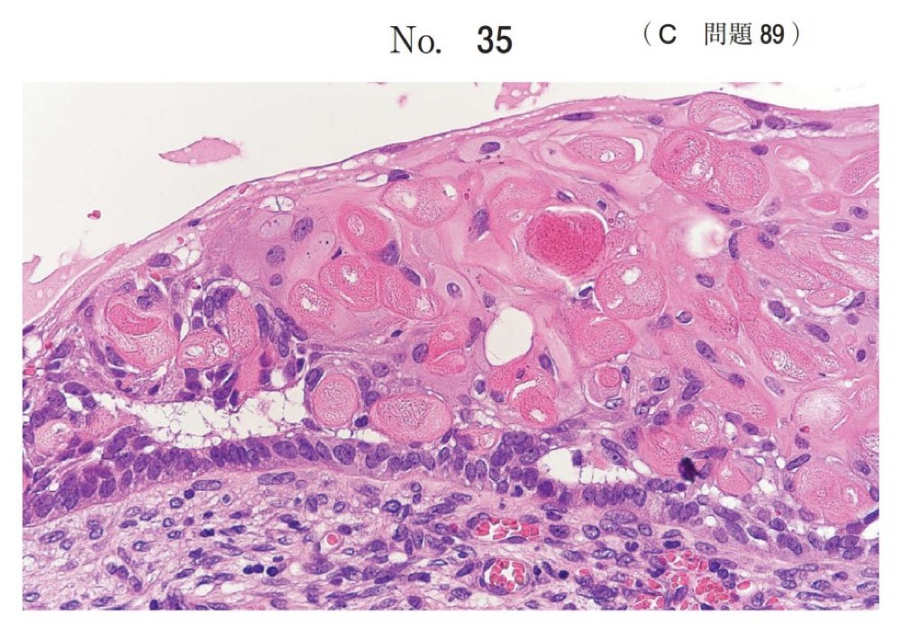 118C089の問題画像