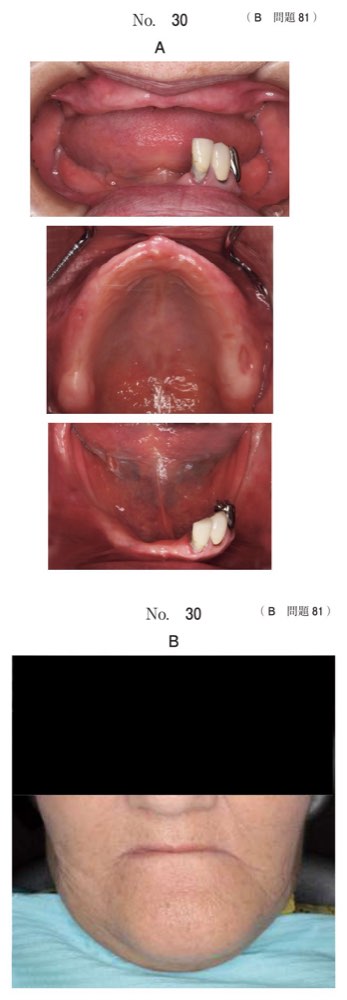 119B081の問題画像