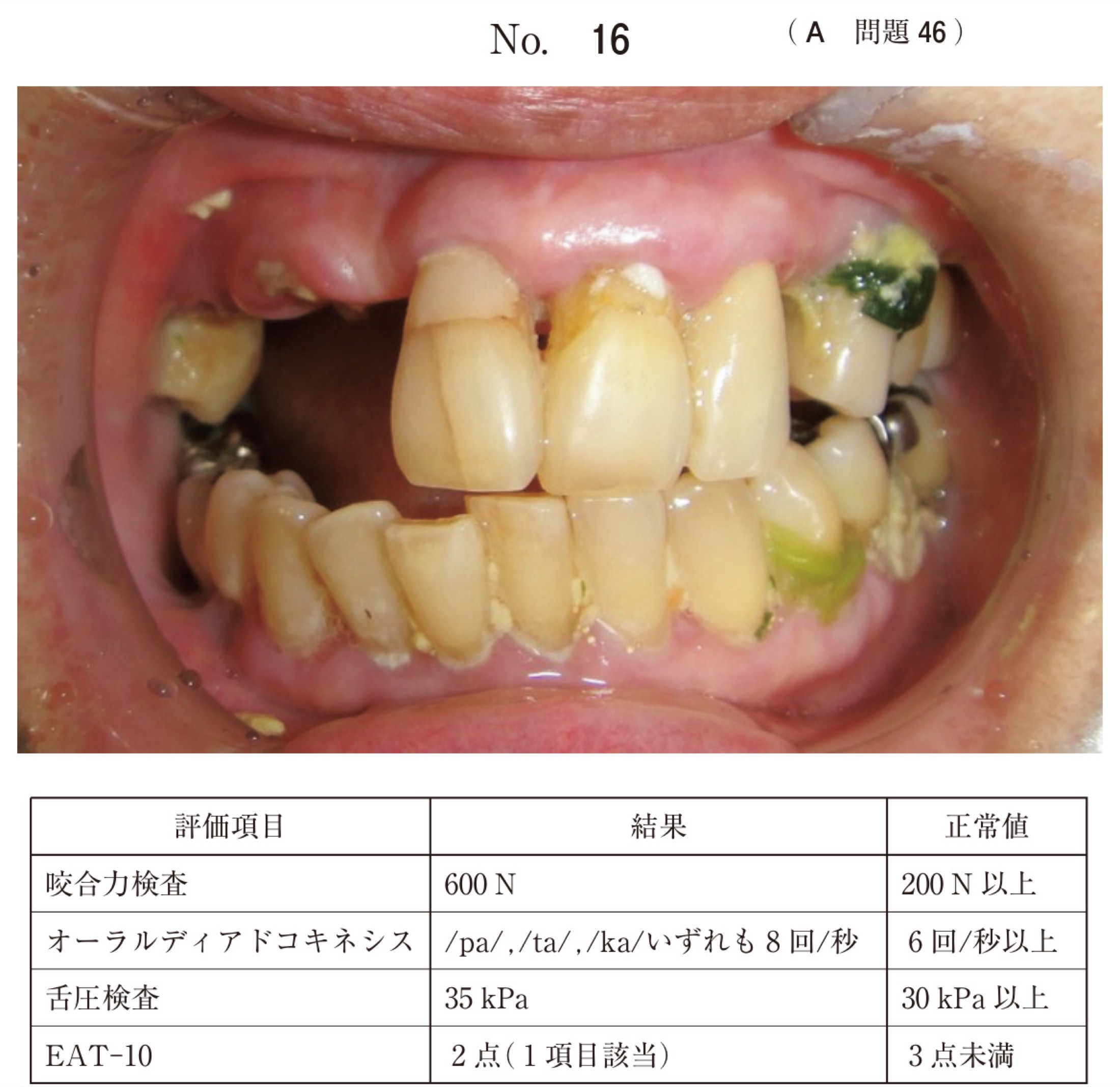 114A046の問題画像