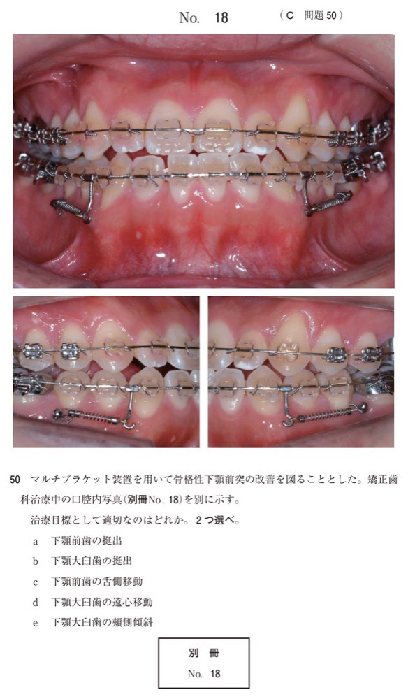 116C050の問題画像