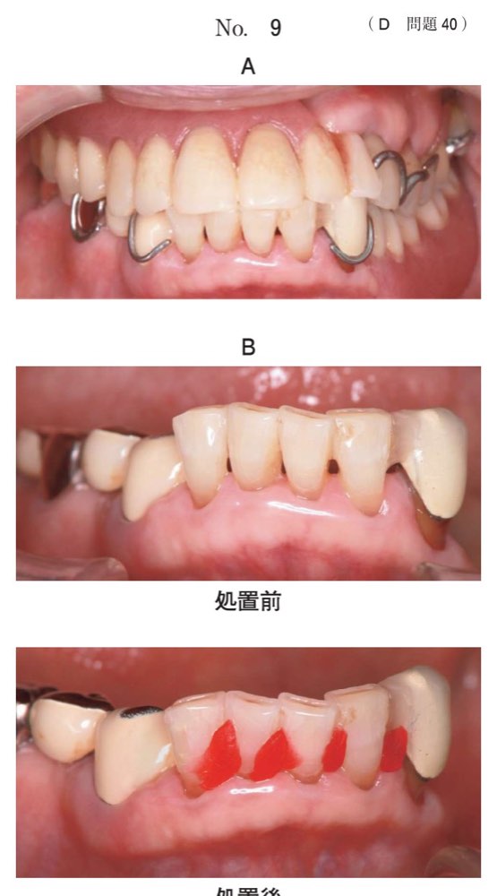 117D040の問題画像