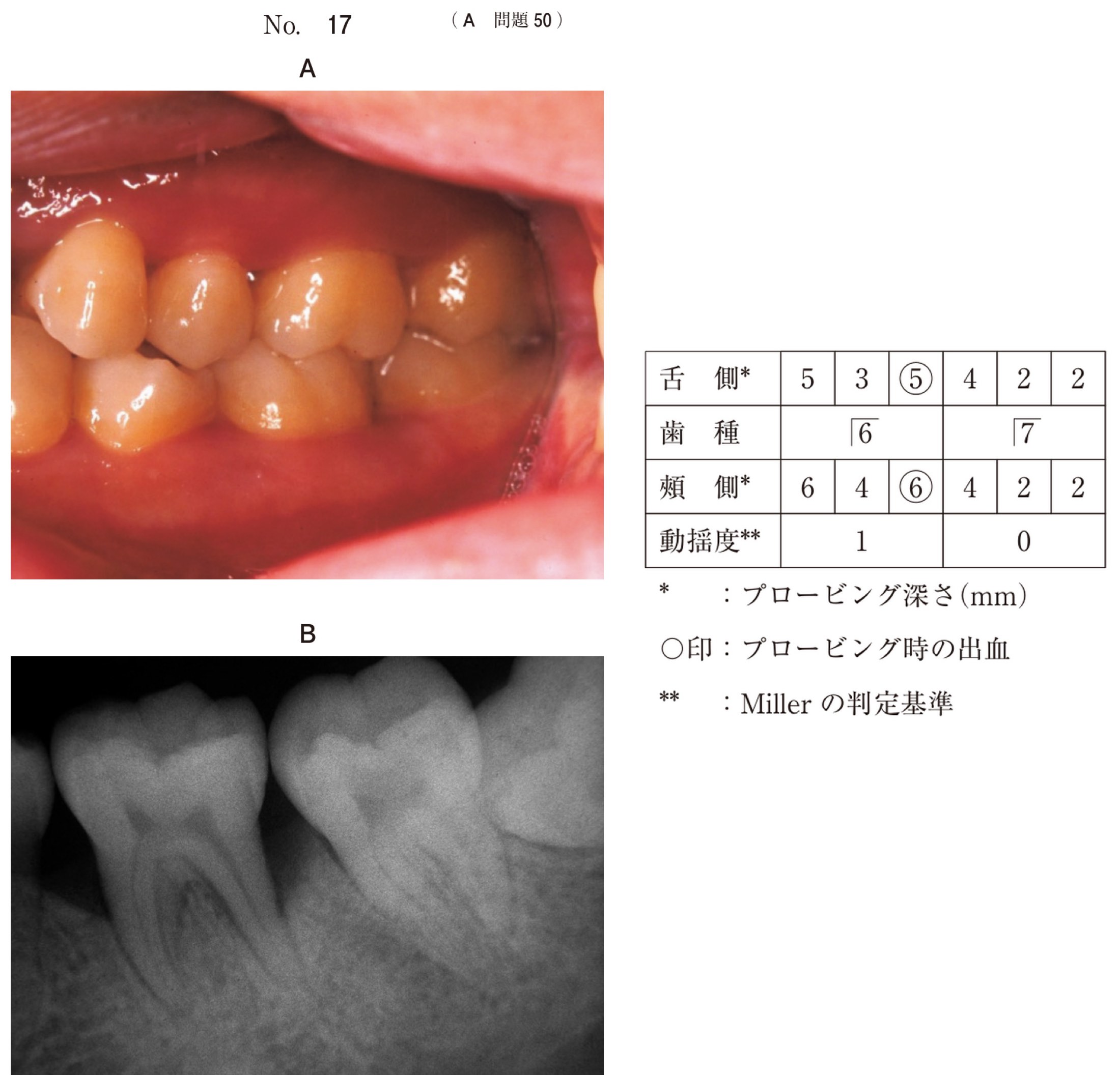 114A050の問題画像