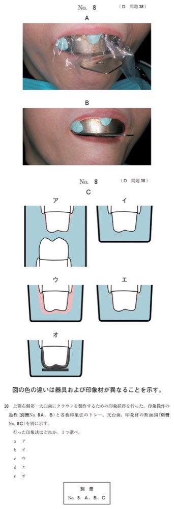 117D038の問題画像