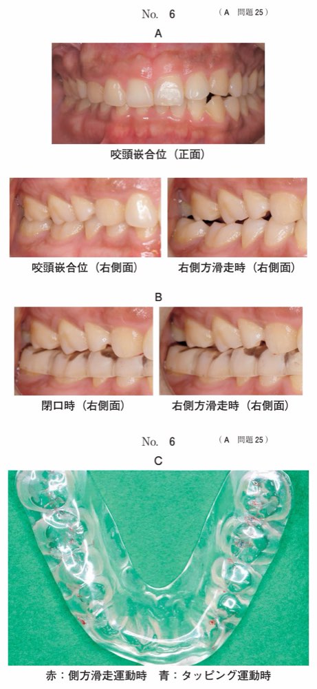 117A025の問題画像