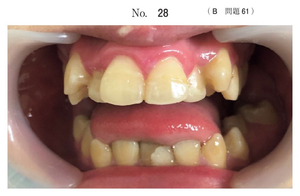 115B061の問題画像