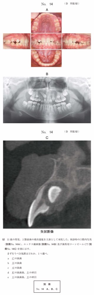 115D052の問題画像