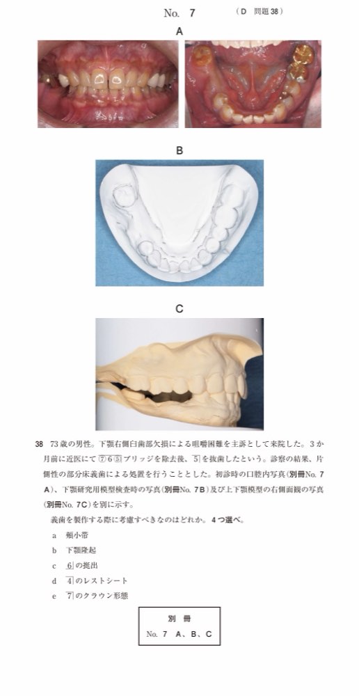 115D038の問題画像