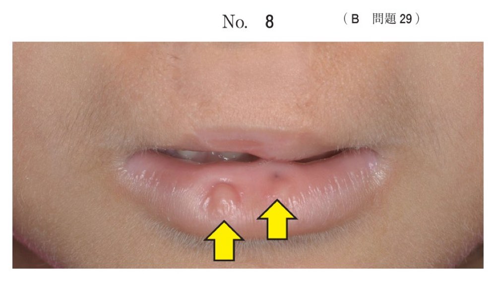 115B029の問題画像