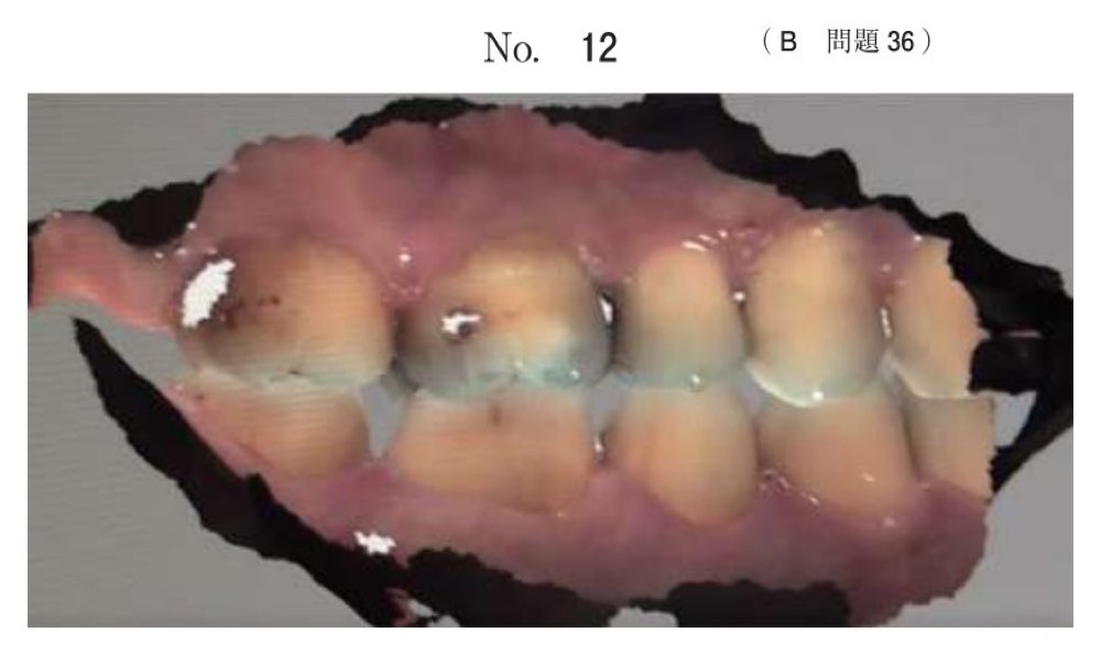 115B036の問題画像