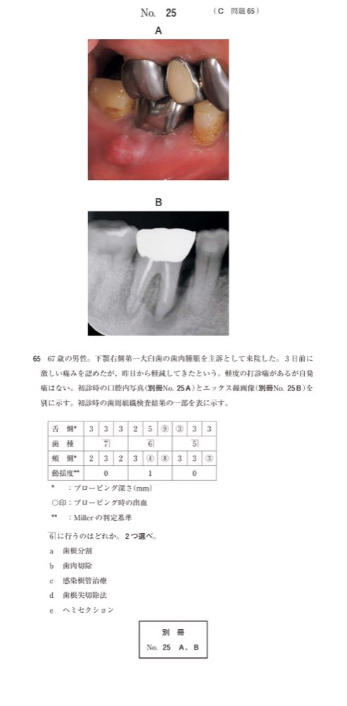 117C065の問題画像